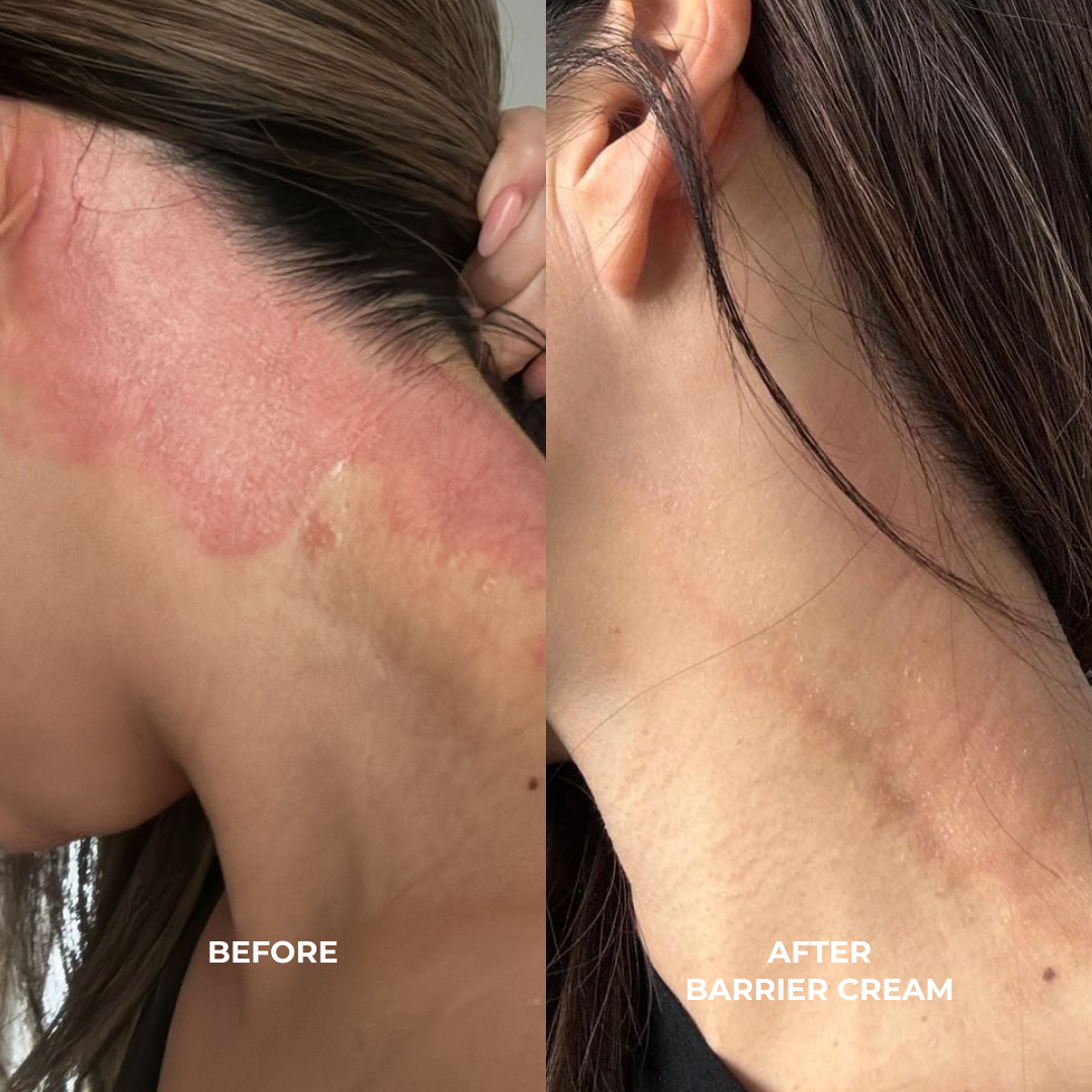 BARRIER CREAM: Ceramides + Blueberry